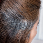 Clinician examining a patient's grey hair