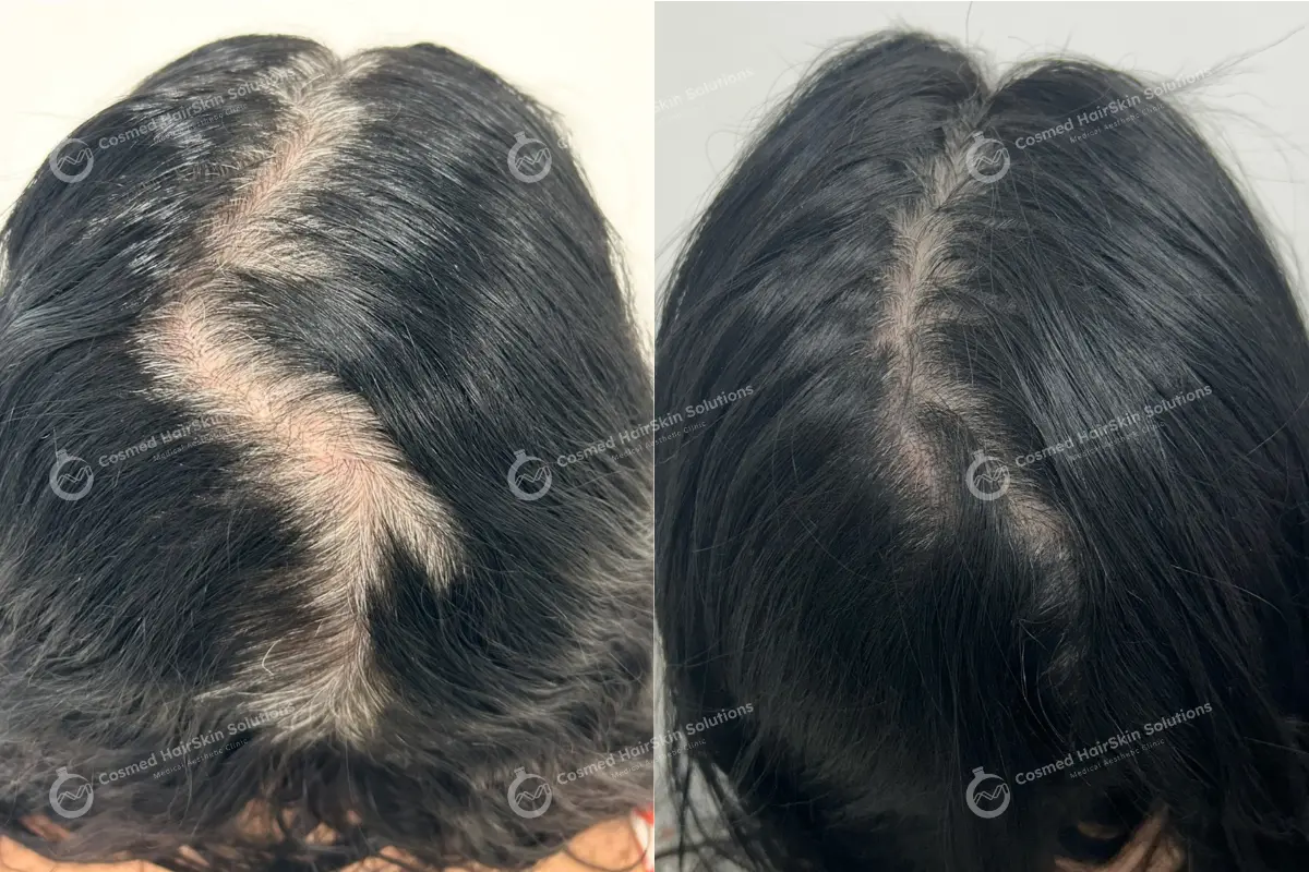 Results after treatment at Cosmed