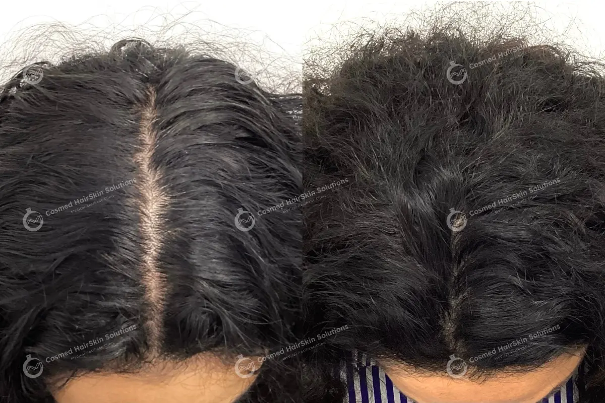 Results after treatment at Cosmed