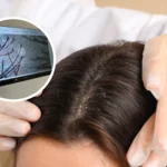 scalp examination