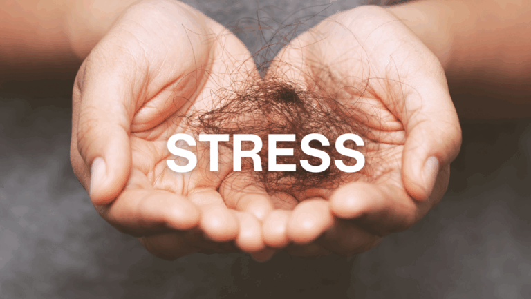 Tell if your hair loss is due to stress