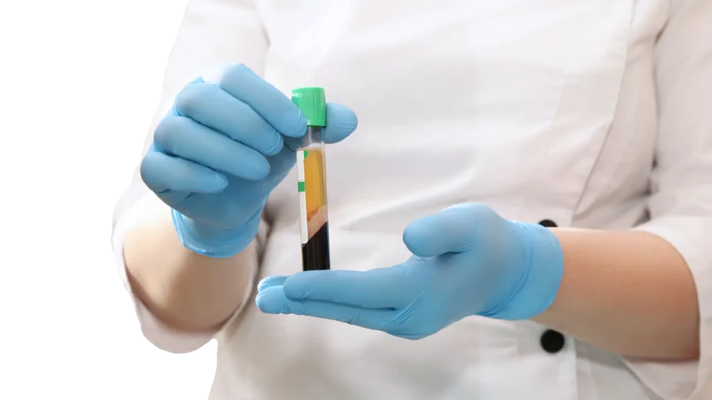 A practitioner holding platelet enriched plasma