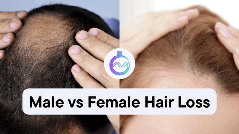 male vs female hair loss
