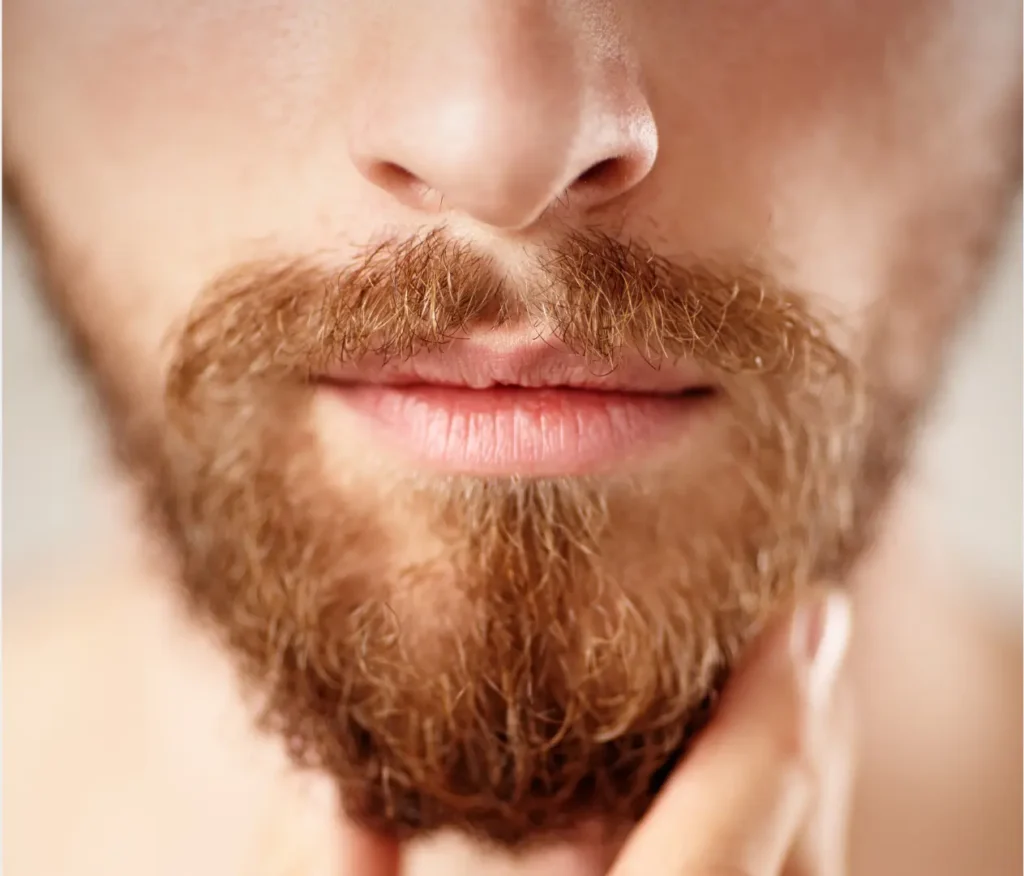 PRP Beard Growth