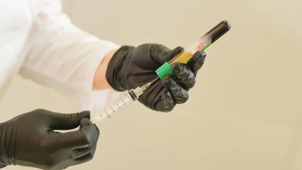 PRP is an accessable entry point for hair regrowth