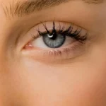 PRP Undereye